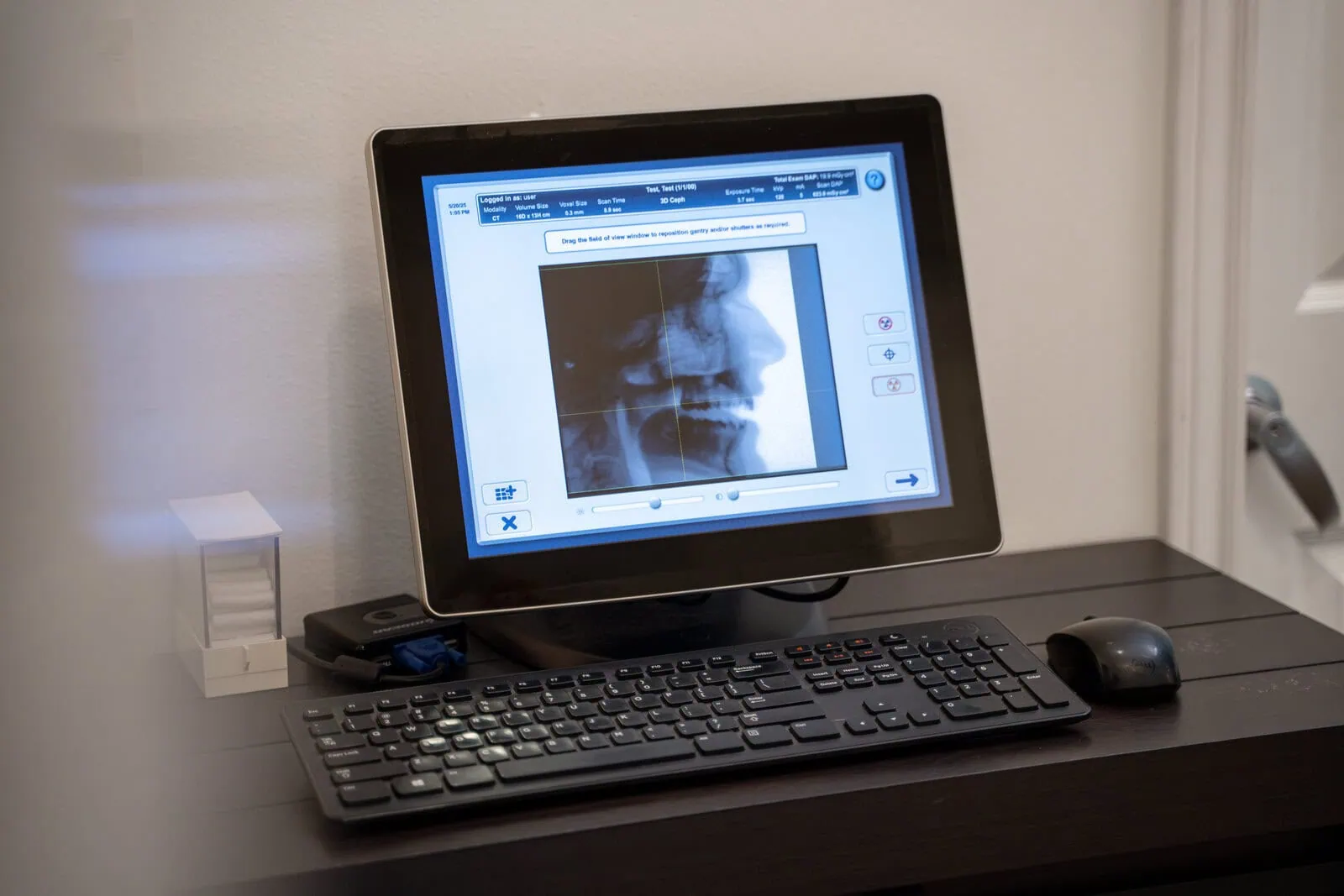 Computer monitor displaying a dental x-ray image of a patient's head with a black keyboard and mouse on a dark desk.